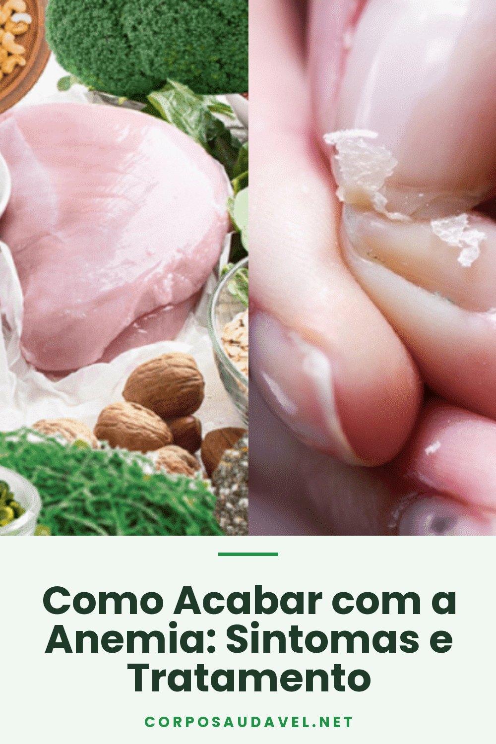 Como Acabar com a Anemia: Sintomas e Tratamento