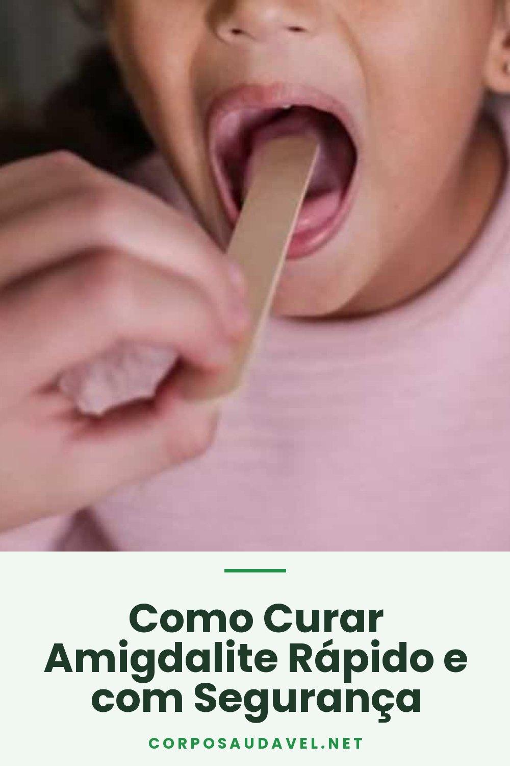 Como Curar Amigdalite Rápido e com Segurança