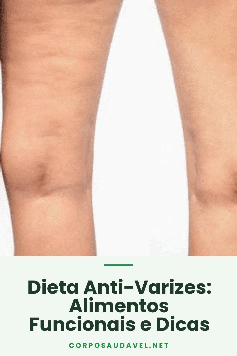 Dieta Anti-Varizes: Alimentos Funcionais e Dicas