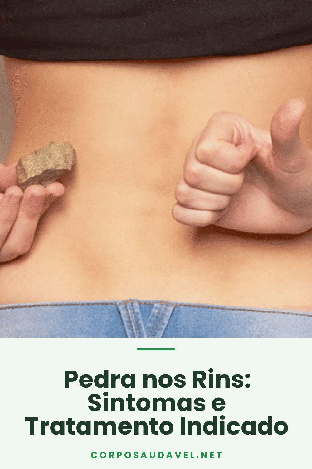 Pedra nos Rins: Sintomas e Tratamento Indicado