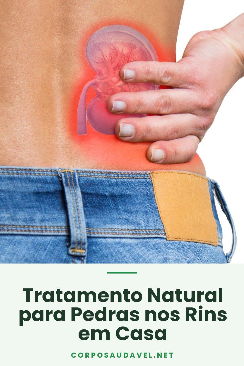 Tratamento Natural para Pedras nos Rins em Casa